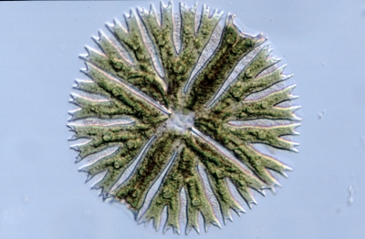 Micrasterias radiosa