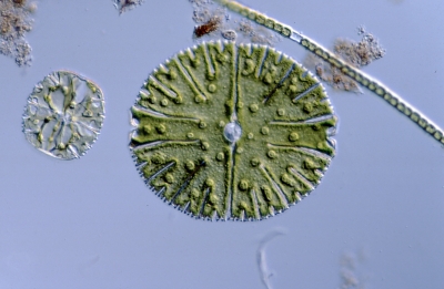 Micrasterias thomasiana