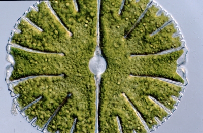 Micrasterias thomasiana