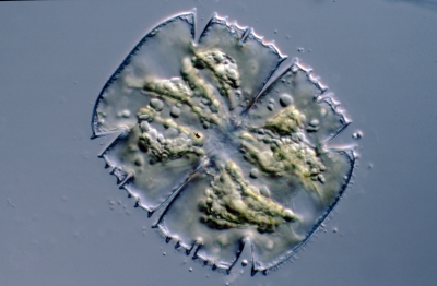 Micrasterias truncata