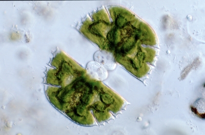 Micrasterias truncata