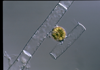 Mougeotia scalaris