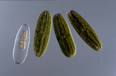 Netrium digitus