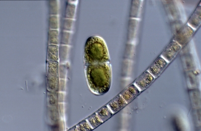 Penium silvae-nigrae