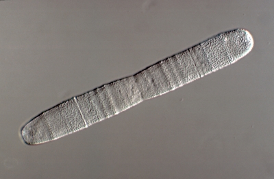 Penium margaritaceum