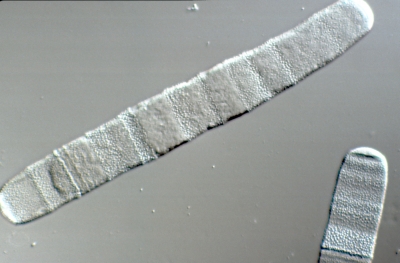Penium margaritaceum