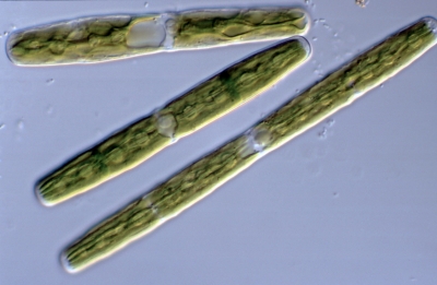 Penium spirostriolatum