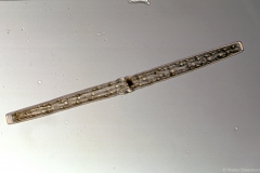 Pleurotaenium