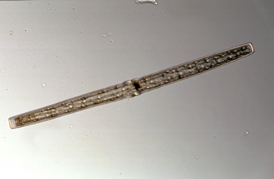 Pleurotaenium trabecula