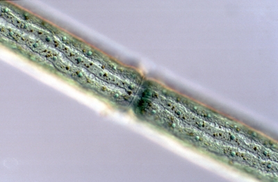 Pleurotaenium trabecula