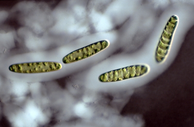 Soirotaenia condensata