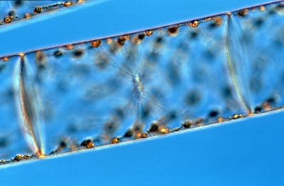Spirogyra glabra