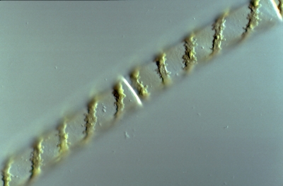 Spirogyra spec.