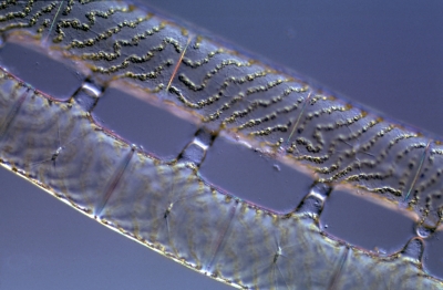 Spirogyra glabra