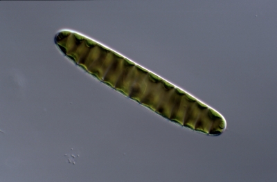 Spirotaenia condensata