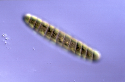 Spirotaenia condensata