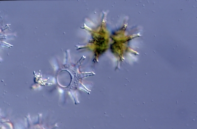 Staurastrum arctiscon