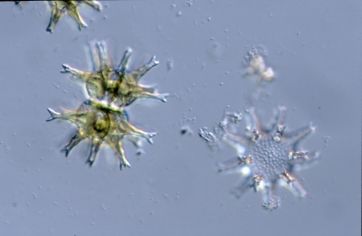 Staurastrum arctiscon