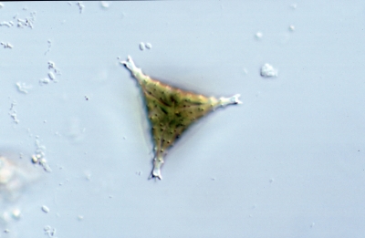 Staurastrum cingulum