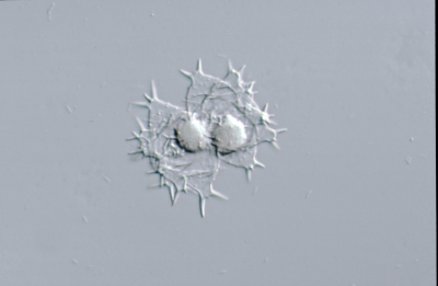 Staurastrum forficulatum