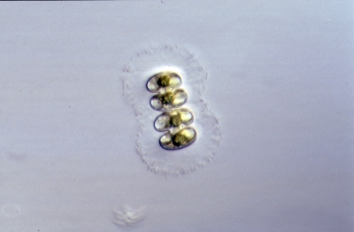 Staurastrum muticum