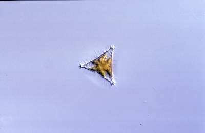 Staurastrum spec.