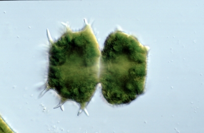 Xanthidium armatum