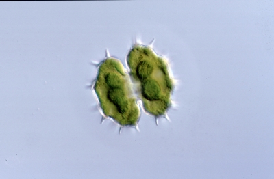 Xanthidium brebissonii
