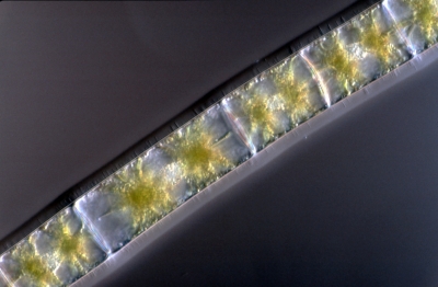 Zygnema spec.