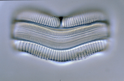 Achnanthes spec.