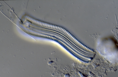 Achnanthes spec.