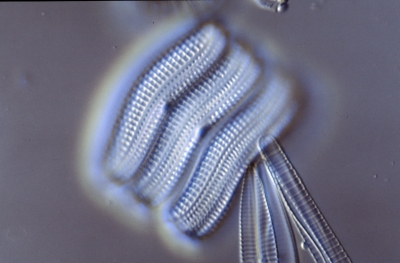Achnanthes brevipes