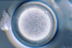 Actinocyclus