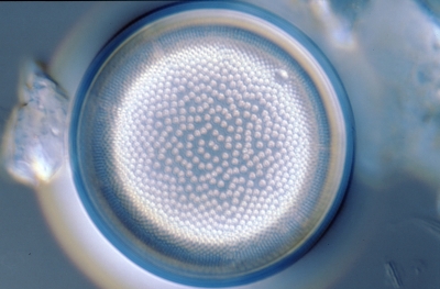 Actinocyclus octonarius