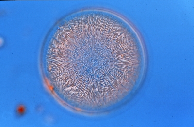 Actinocyclus ehrenbergii