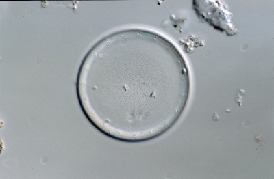 Actinocyclus ehrenbergii