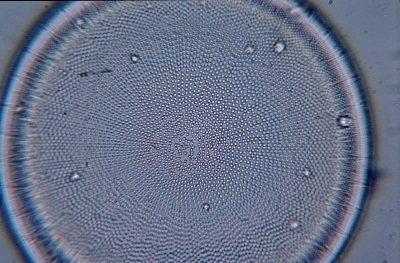 Actinocyclus octonarius