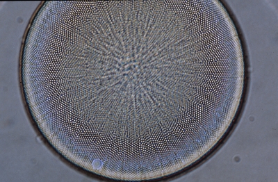 Actinocyclus octonarius