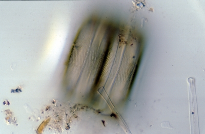 Actinocyclus normannii