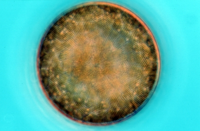 Actinocyclus normannii