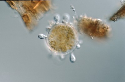 Actinocyclus normannii