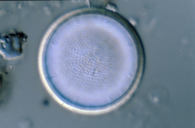 Actinocyclus normannii