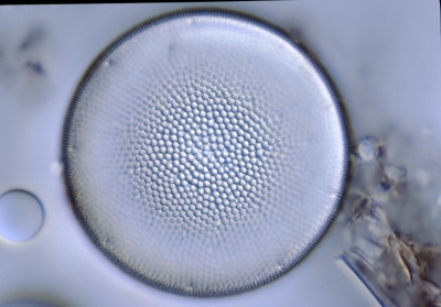 Actinocyclus normannii