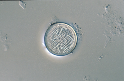 Actinocyclus n. f.subsalsa