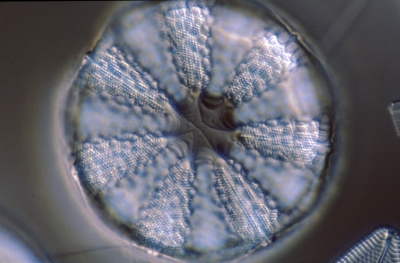 Actinocyclus splendens?