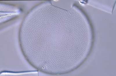 Actinocyclus ehrenbergii