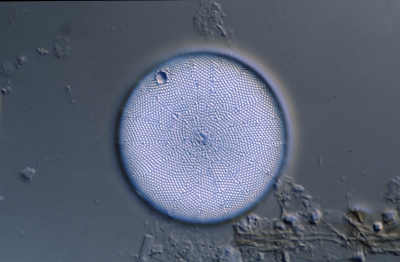 Actinocyclus tenuissimus