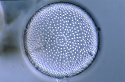 Actinocyclus ehrenbergii