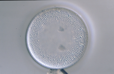 Actinocyclus normannii