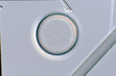 Actinocyclus ehrenb.var.crassa